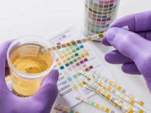 Urine onderzoek huisarts